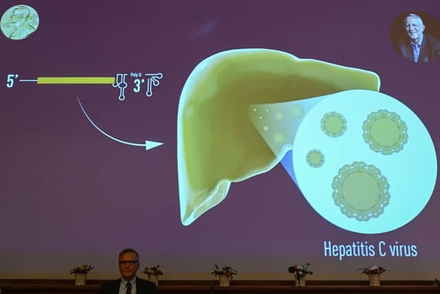 Hepatitis C cure will now be available to under-12s on NHS in ‘world first’ (Photo by JONATHAN NACKSTRAND/AFP via Getty Images)