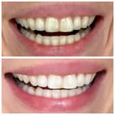 The MySweetSmile brand is one of the top players in this growing market