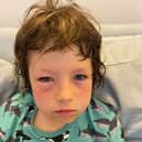 Lawrence, 8, after he was gassed by police after being caught in a pro-Palestine protest in Paris.