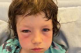 Lawrence, 8, after he was gassed by police after being caught in a pro-Palestine protest in Paris.