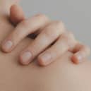 Could you tell the difference between a harmless rash from a fatal illness? (Photo: Pexel, Ximena Mora)