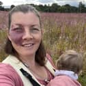 Frith Zerfahs, 44. A mum who wore make-up to "cover up" her birthmark for 20 years says having kids helped her "love" her difference as she didn't want to "hide" from them. 
