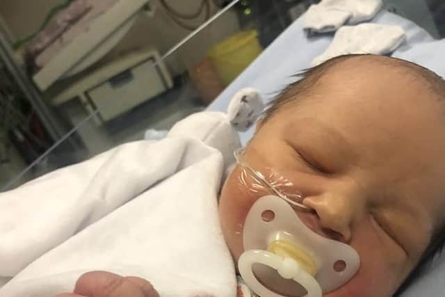 Baby Zak pictured after his second operation at Glenfield Hospital when he was only four days old EMN-211201-155705001