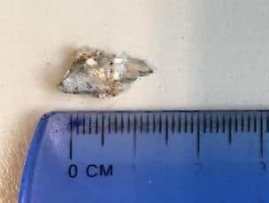 The sharp piece of metal found in the Krispy Kreme doughnut bought in Melton Mowbray