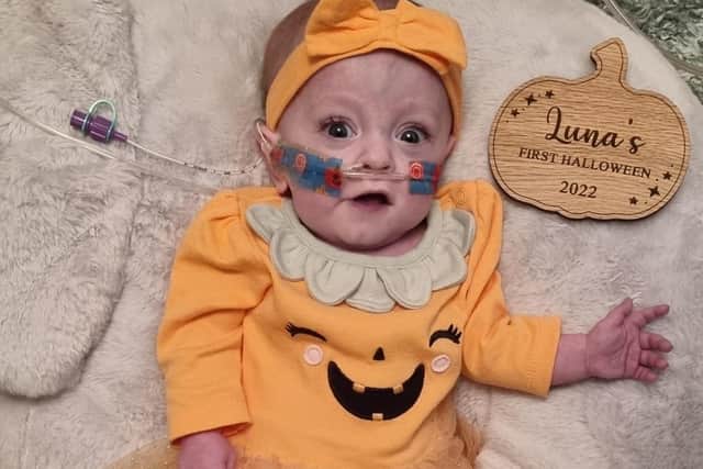 Baby Luna, who sadly passed away aged 10 months