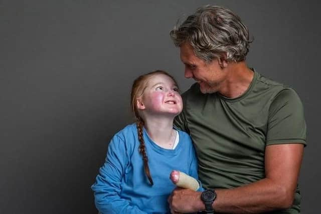 Isla Grist, who has a rare skin blistering condition, with her dad, Andy
PHOTO: Debra