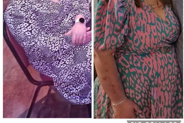 Natalie pictured before her Slimming World classes started
