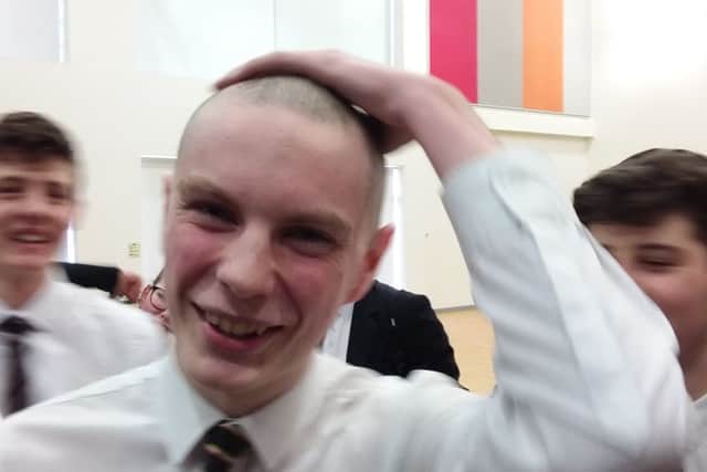 Adam Billson after losing his hair PHOTO: Supplied