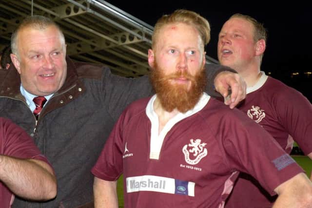 Melton RFC player-coach Gareth Collins shows the scars of battle at the first County Cup final triumph EMN-190417-150053002