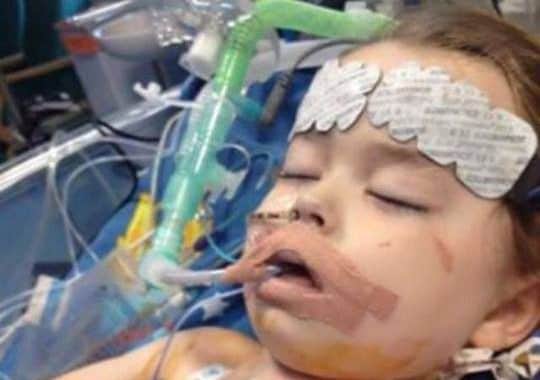 This photo of Jack was taken two years ago, four days after his life-saving heart surgery at the Glenfield Hospital unit EMN-160713-140446001