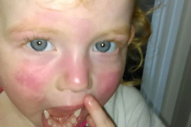 Martha's skin after using the wipes.
