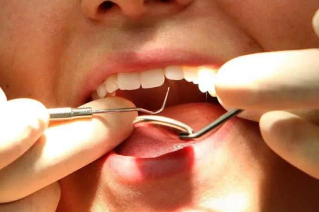 A dentist at work, as figures show that the number of tooth extractions in hospital for children aged four and under has risen by almost a quarter in the last decade.